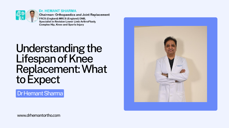 Understanding the Lifespan of Knee Replacement: What to Expect